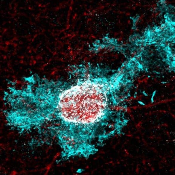 This shows an astrocyte.