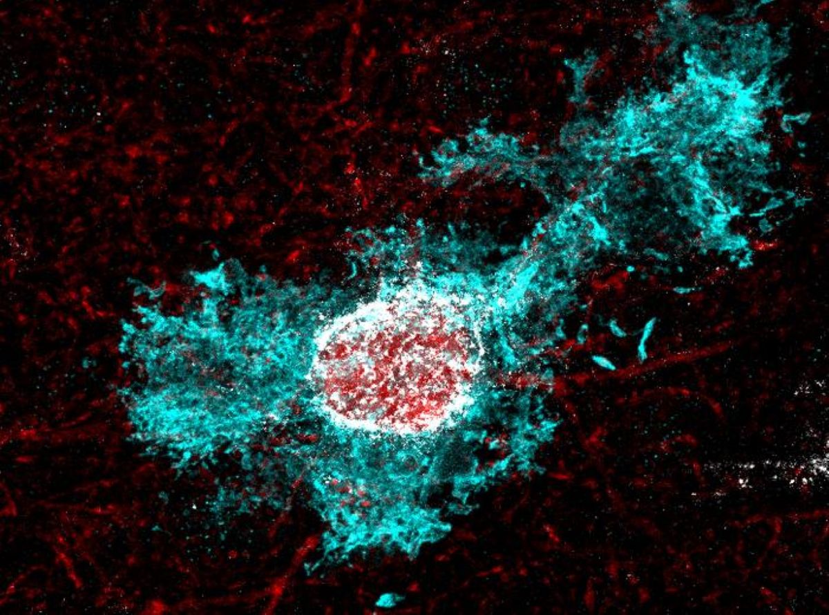 This shows an astrocyte.