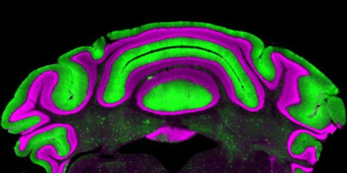 This shows purkinje cells in a brain slice.