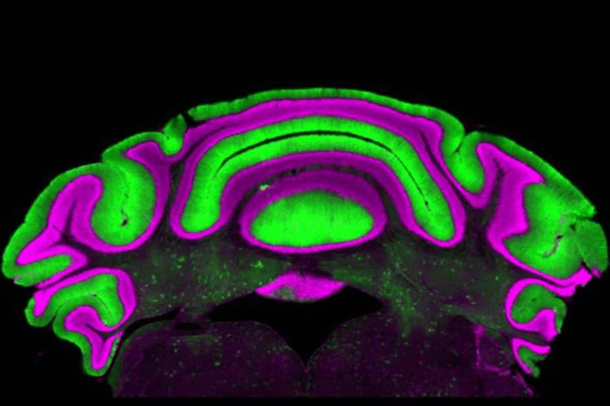 This shows purkinje cells in a brain slice.