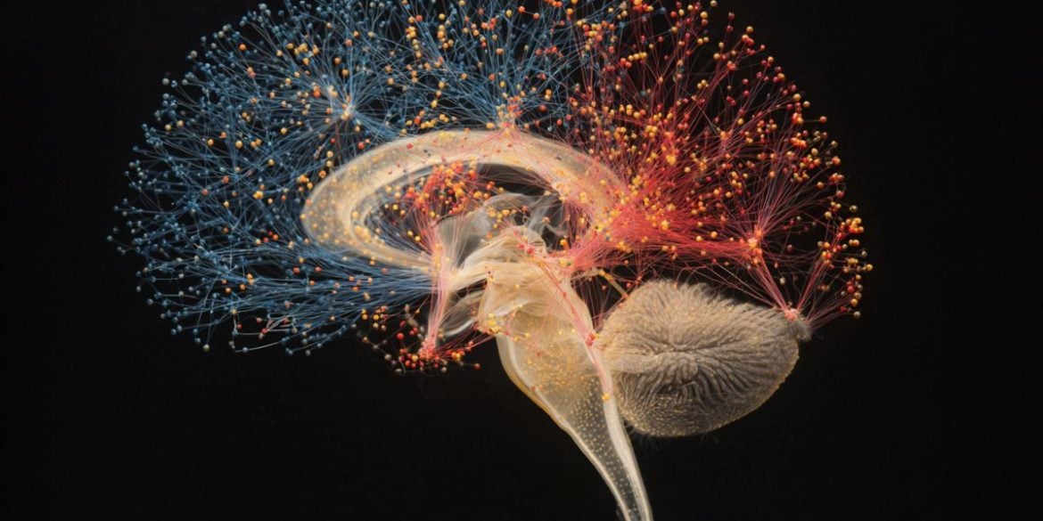 This shows a brain.
