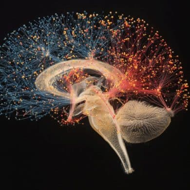 This shows a brain.