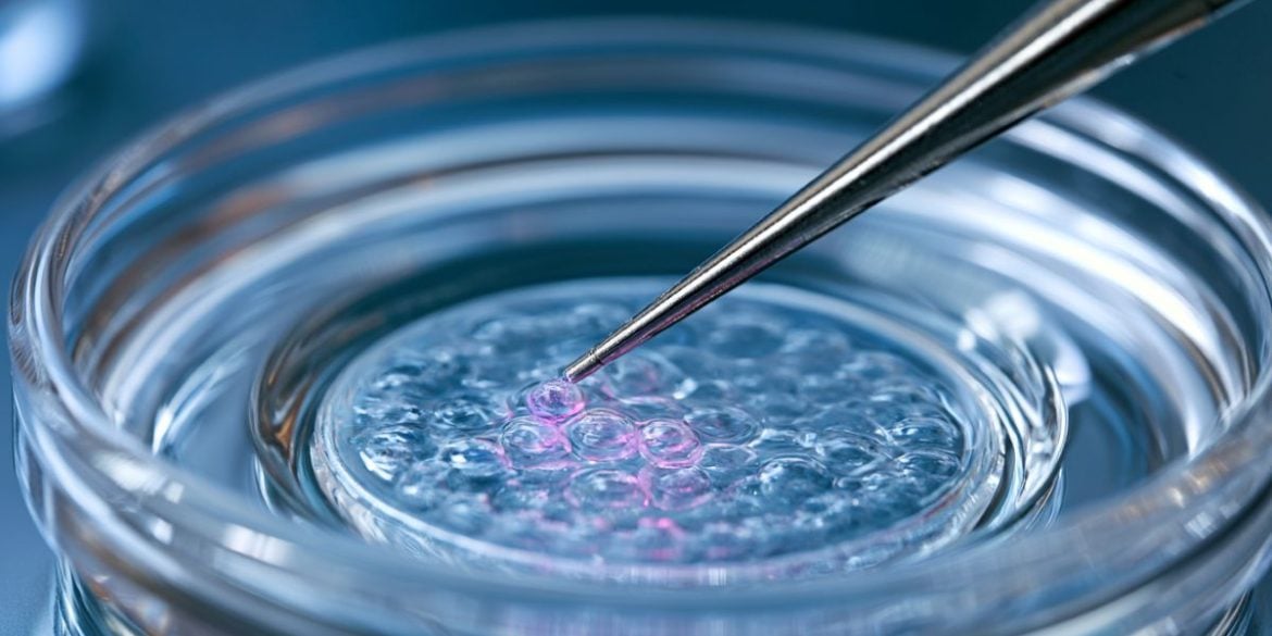 This shows stem cells in a petri dish.
