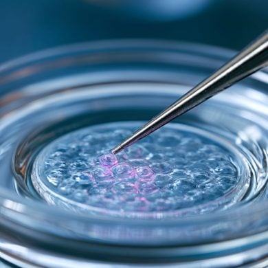 This shows stem cells in a petri dish.