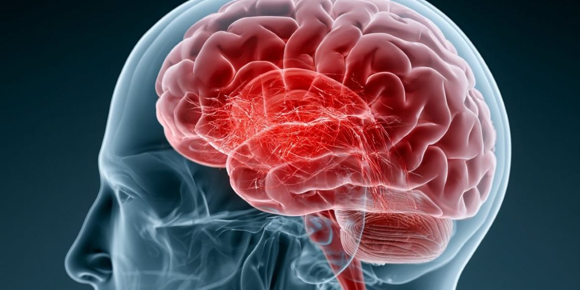 This shows a red brain.