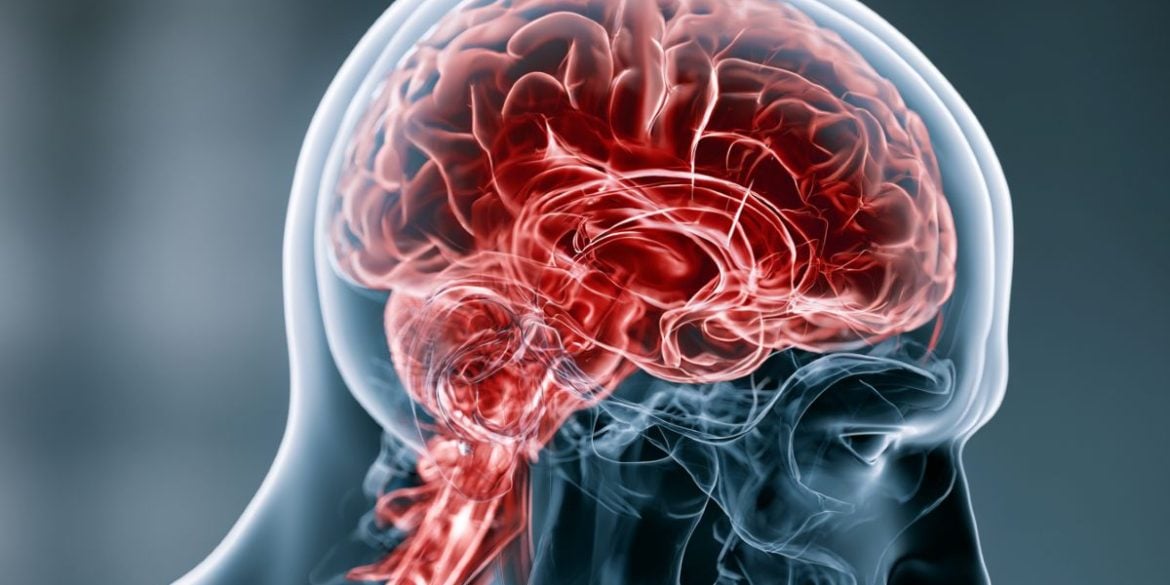 This shows a brain.