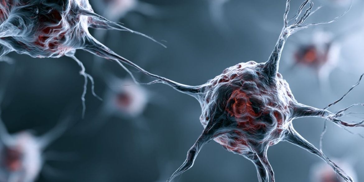 This shows neurons.