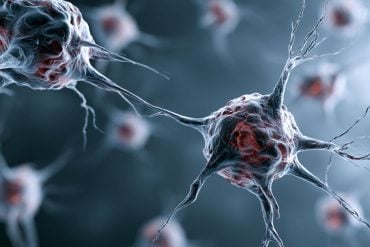 This shows neurons.