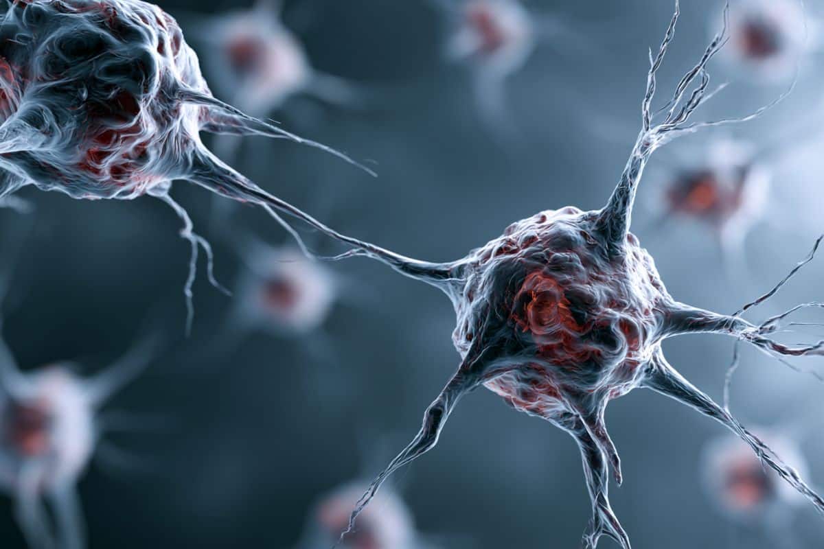 This shows neurons.