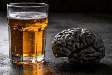 This shows a drink and a brain.