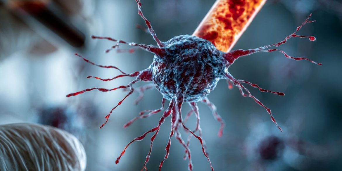 This shows a neuron.