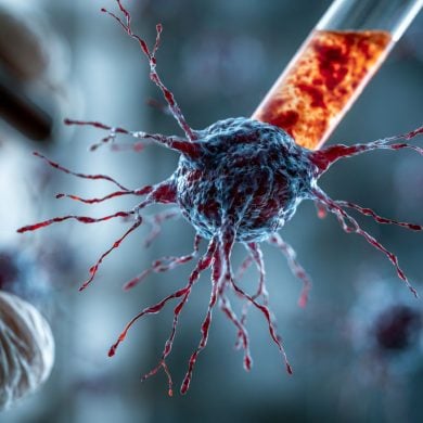 This shows a neuron.
