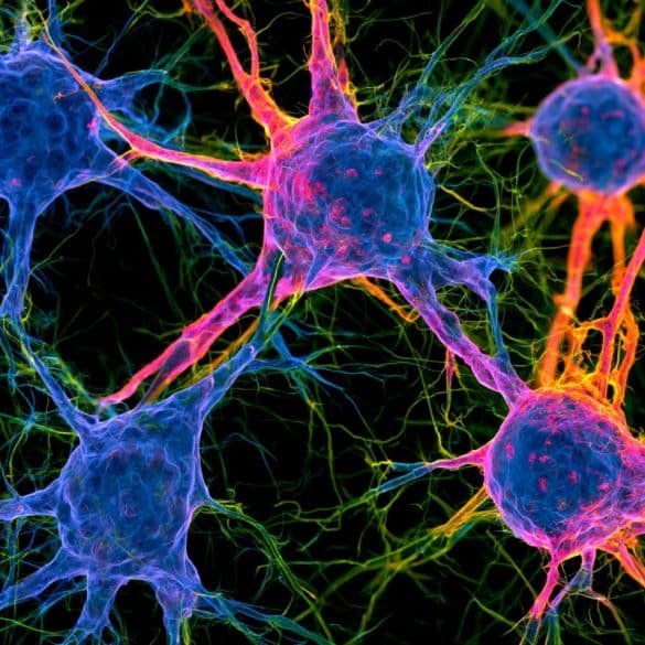 This shows neurons.