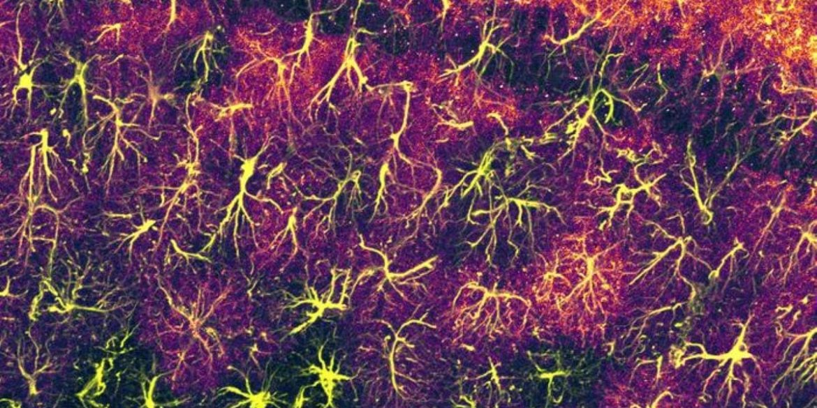 This shows astrocytes.