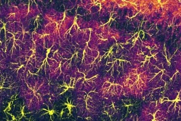 This shows astrocytes.