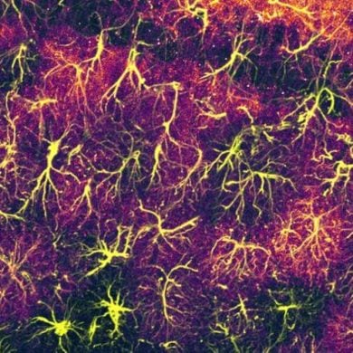 This shows astrocytes.