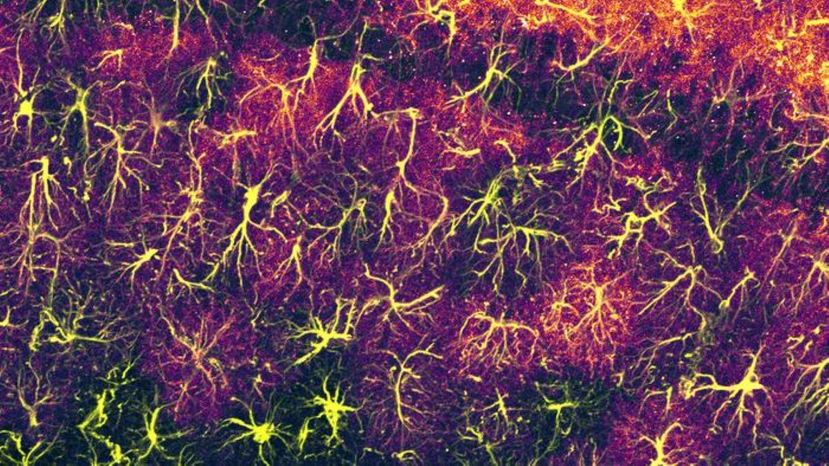 This shows astrocytes.