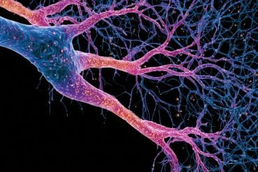 This shows neurons.