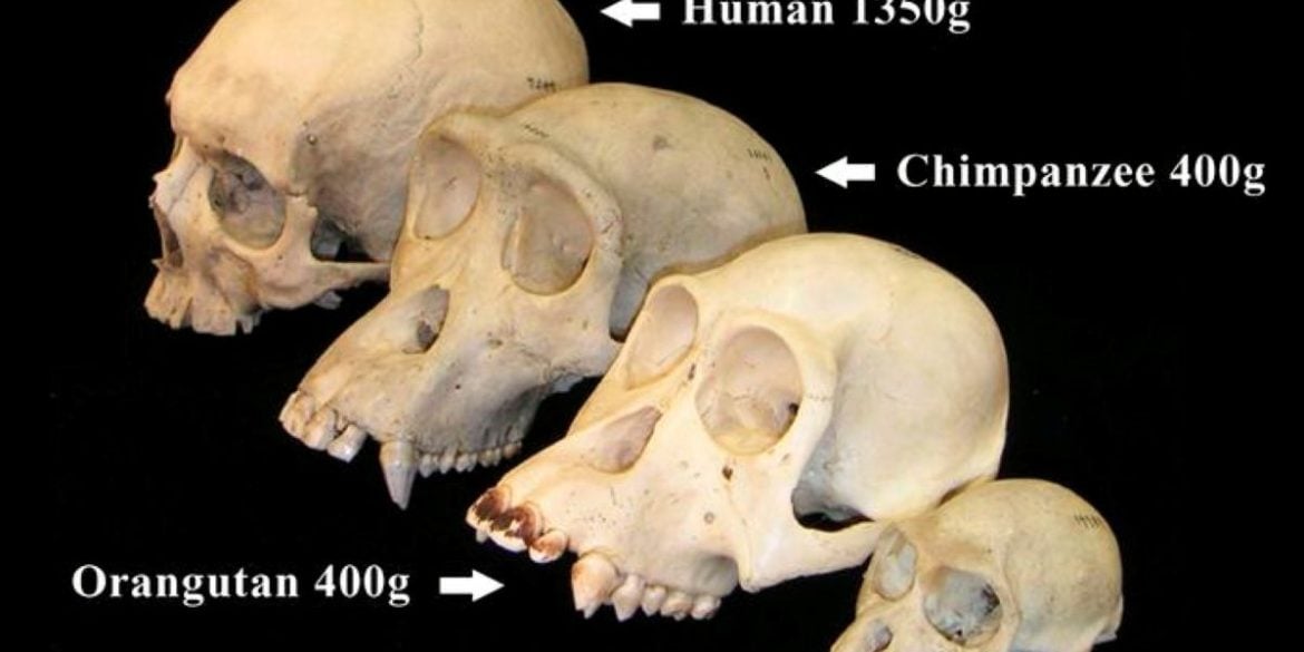 This shows skulls.
