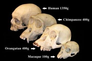 This shows skulls.