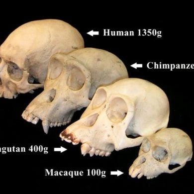 This shows skulls.