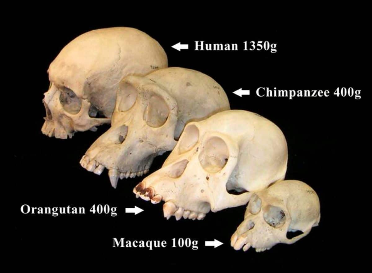 This shows skulls.