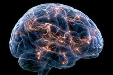 This shows a brain.