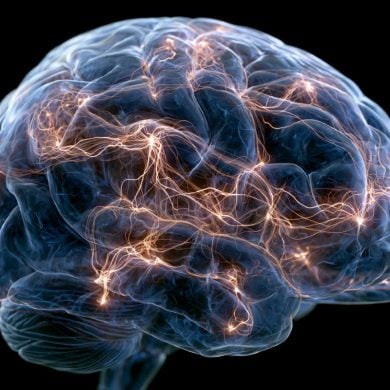 This shows a brain.