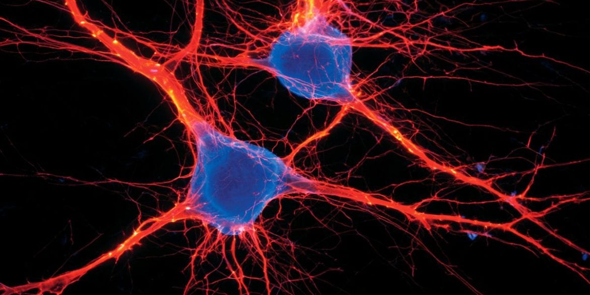 This shows neurons.