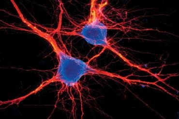 This shows neurons.