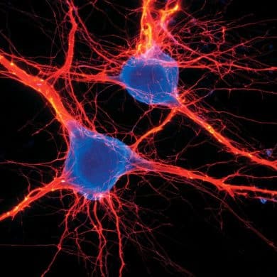 This shows neurons.