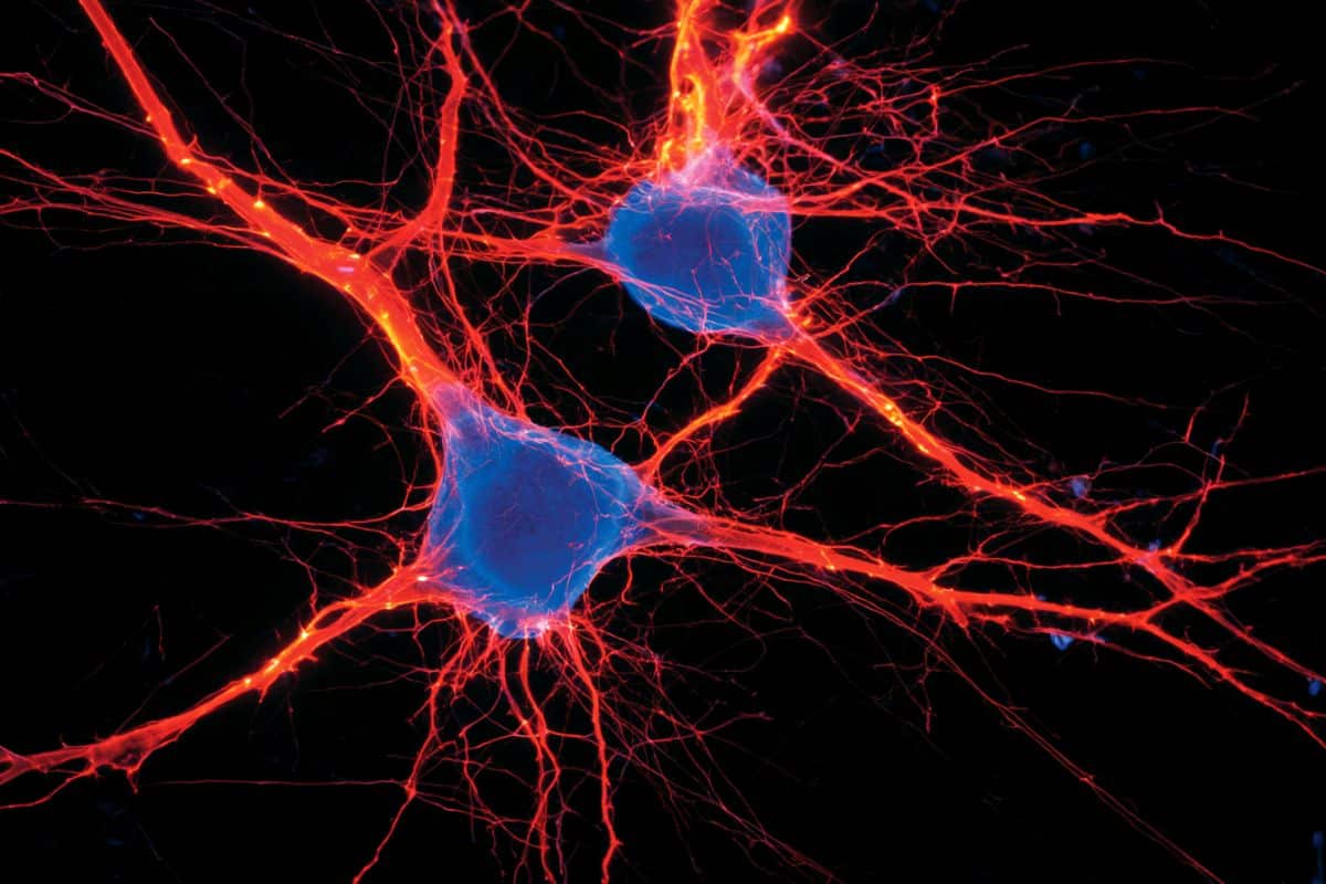 This shows neurons.