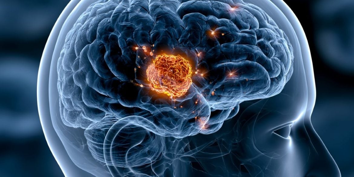 This shows a head and a brain.