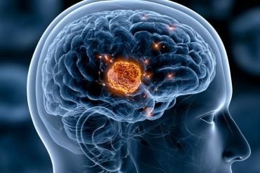 This shows a head and a brain.