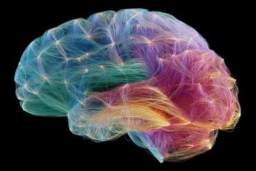 This shows a connectome of the brain.