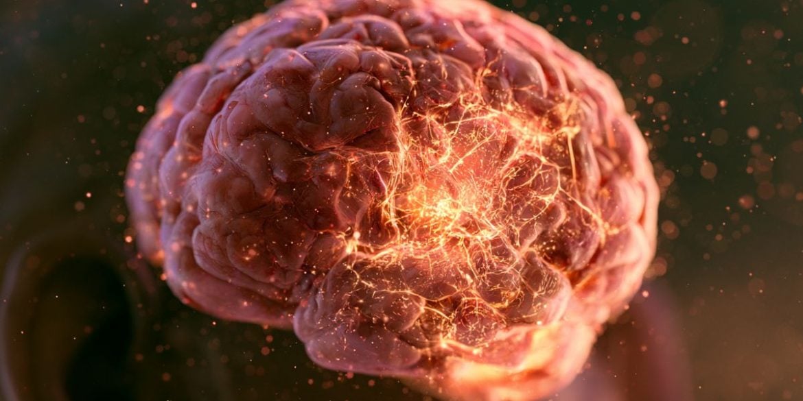 This shows a brain.