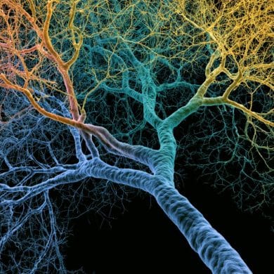 This shows a branching dendrite.