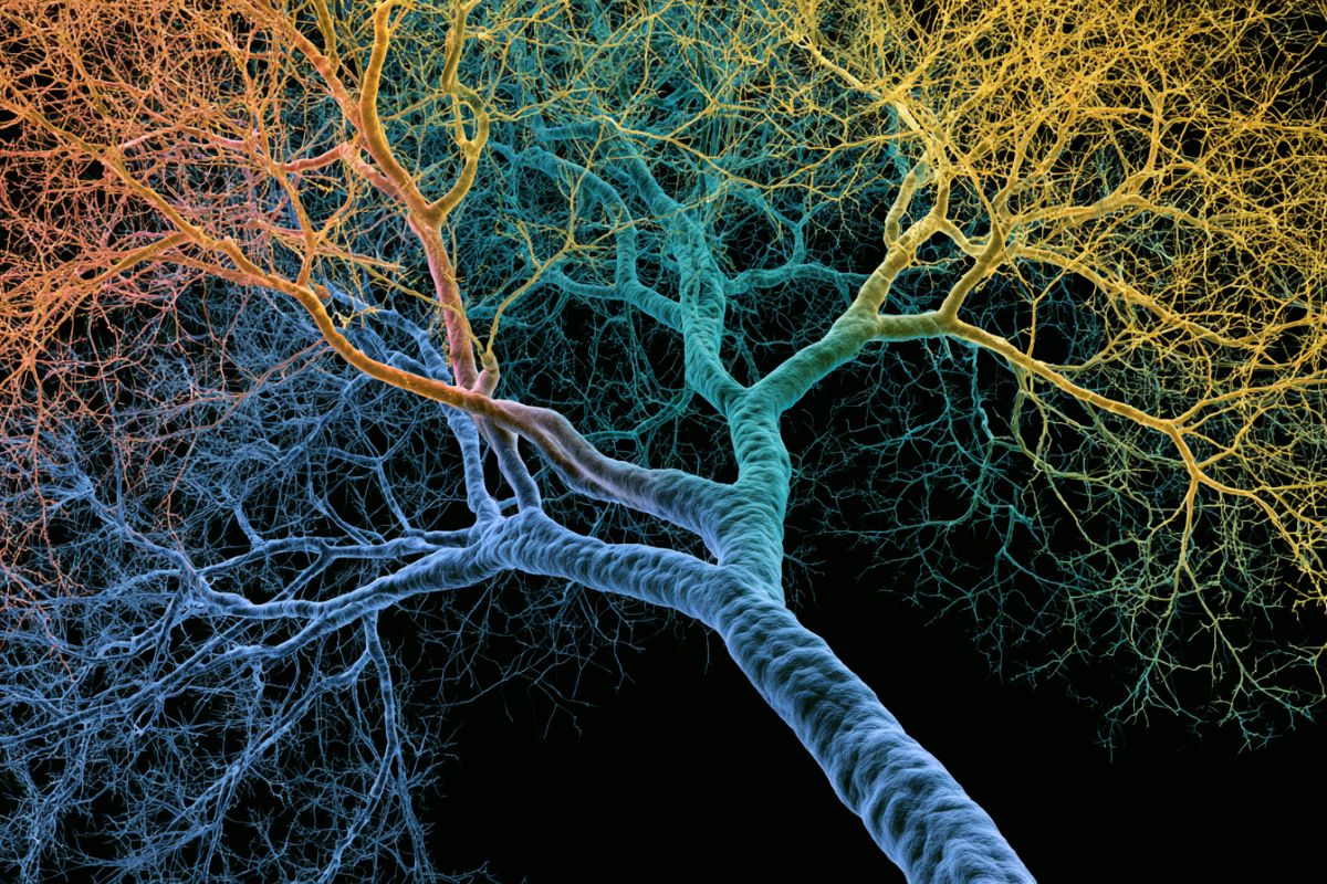 This shows a branching dendrite.