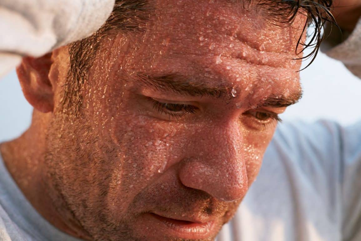 Genetic Cause of Chronic Excessive Sweating Discovered
