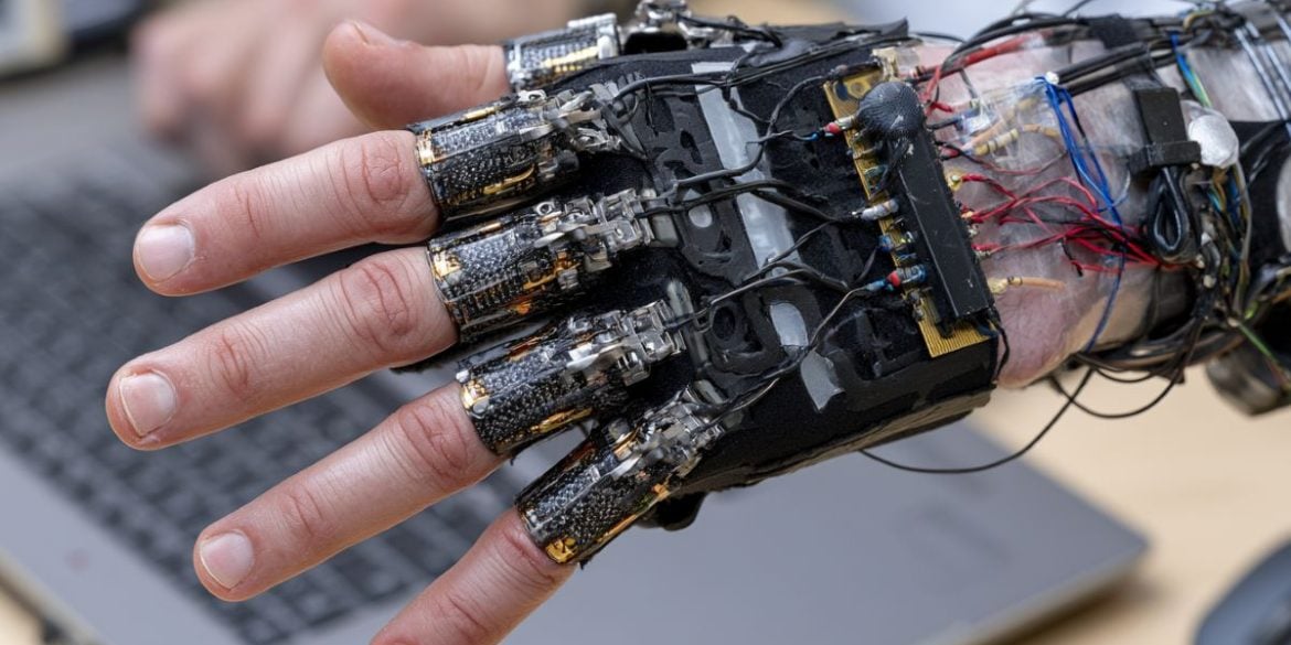 This shows a hand with an exoskeleton.