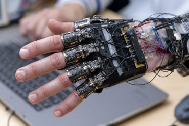 This shows a hand with an exoskeleton.