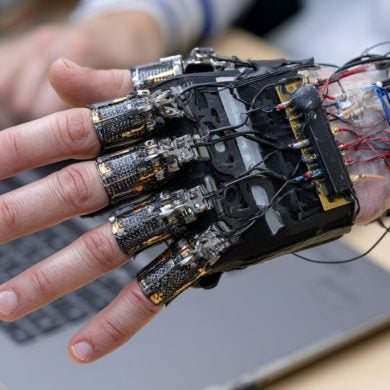 This shows a hand with an exoskeleton.