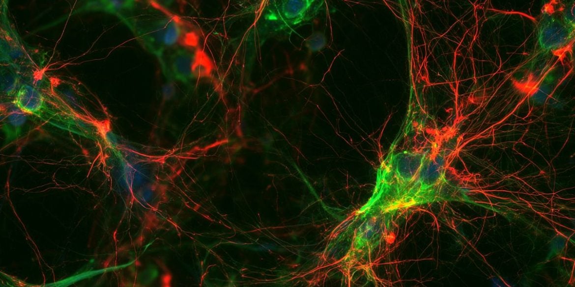 This shows neurons.