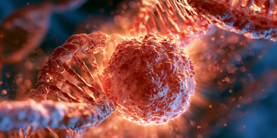 This shows DNA and a glioblastoma cell.