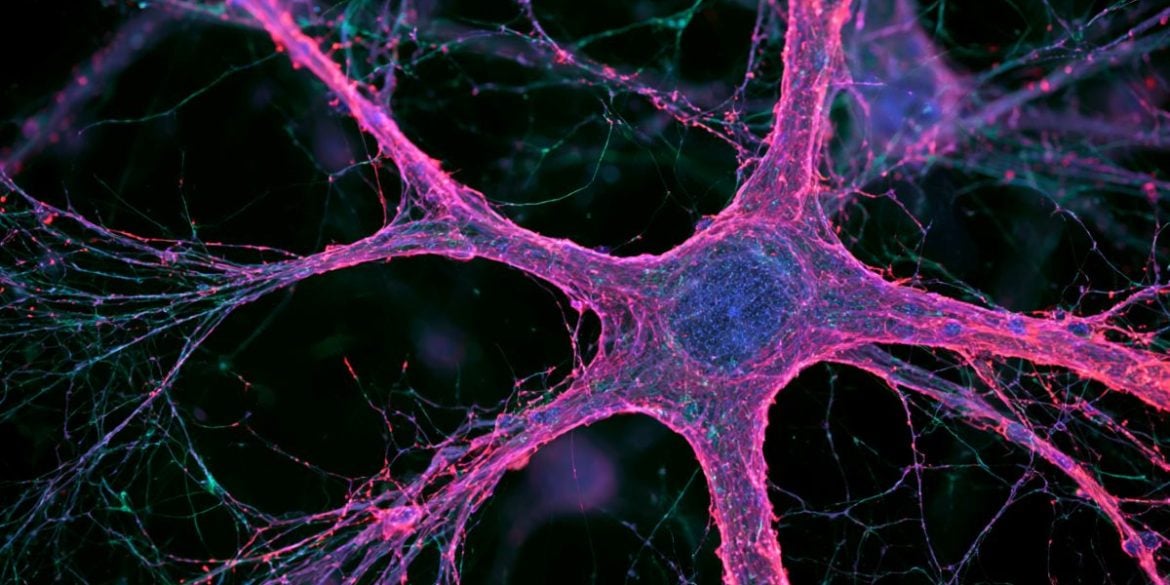 This shows a neuron.