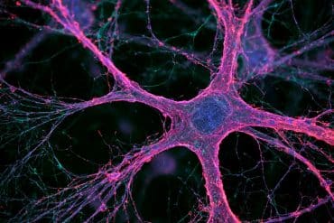 This shows a neuron.
