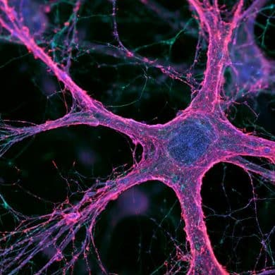 This shows a neuron.