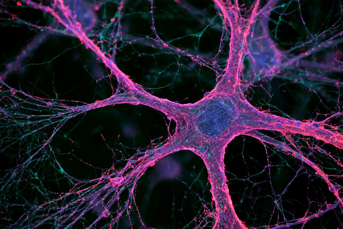 This shows a neuron.