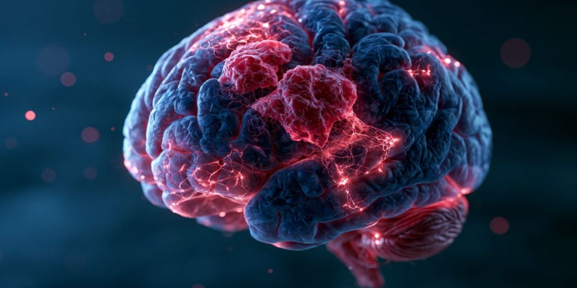 This shows a brain.