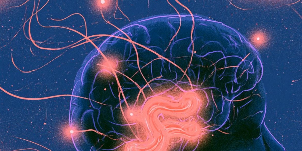 This shows a brain.